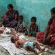 Mothers with babies in hospital during measles outbreak