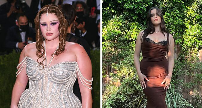 A celebrity before and after taking ozempic